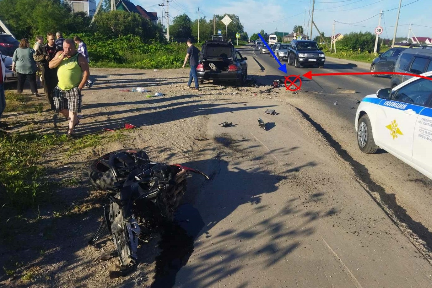 Мотоциклист получил открытый перелом во время ДТП в Сыктывкаре « БНК