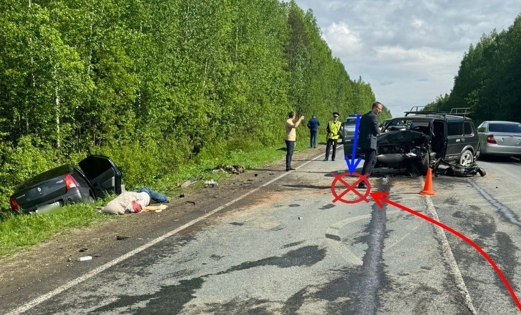 Третья пострадавшая в смертельном ДТП на ухтинской трассе в тяжелом состоянии