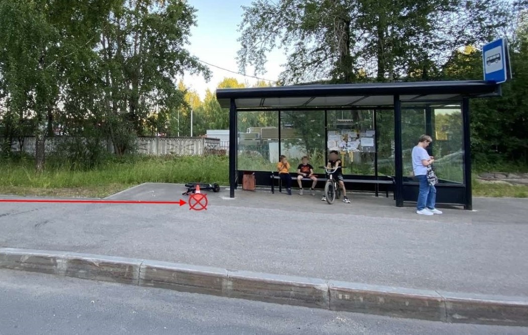 В Сыктывкаре подросток сломал палец во время поездки на электросамокате