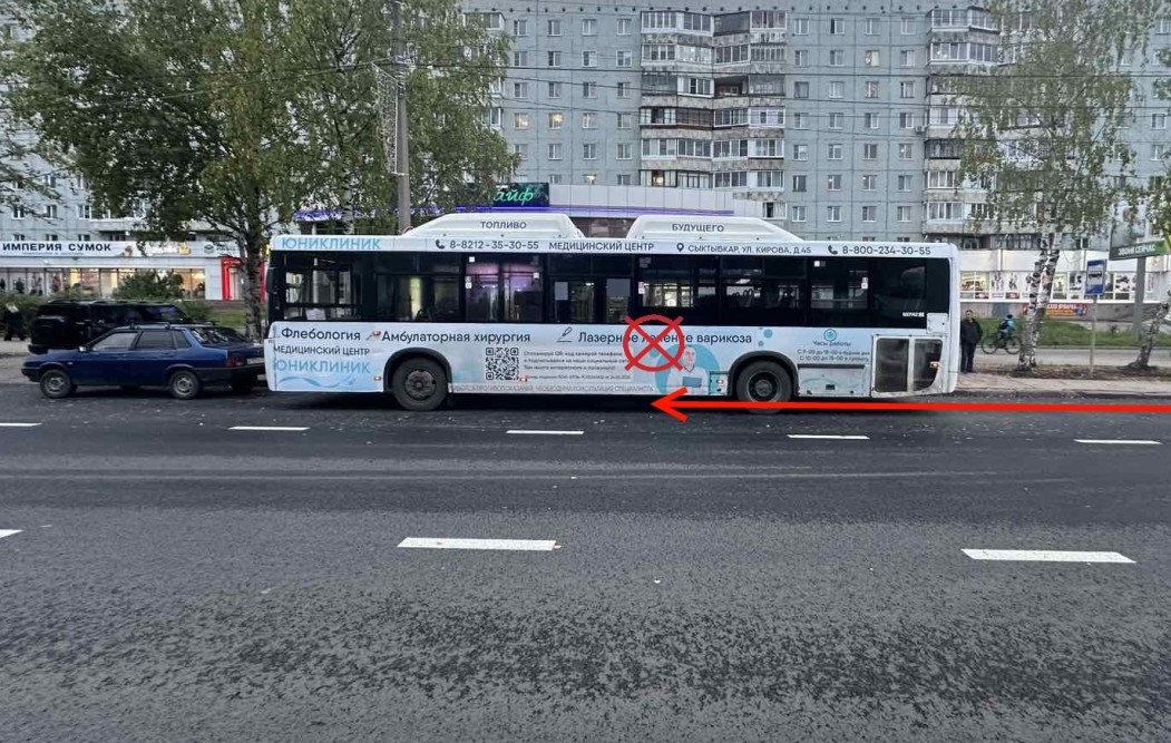 В Сыктывкаре поездка на автобусе закончилась для женщины травмой головы