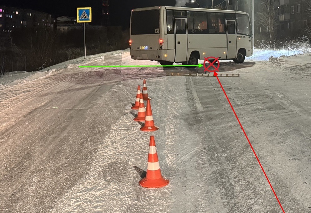 В Воркуте женщину с тяжелыми травмами отправили в больницу после наезда автобуса