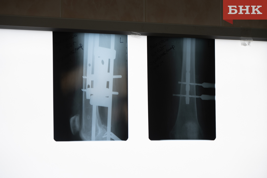 Рентген в травмпункте Сыктывкара запустили после устранения неполадок