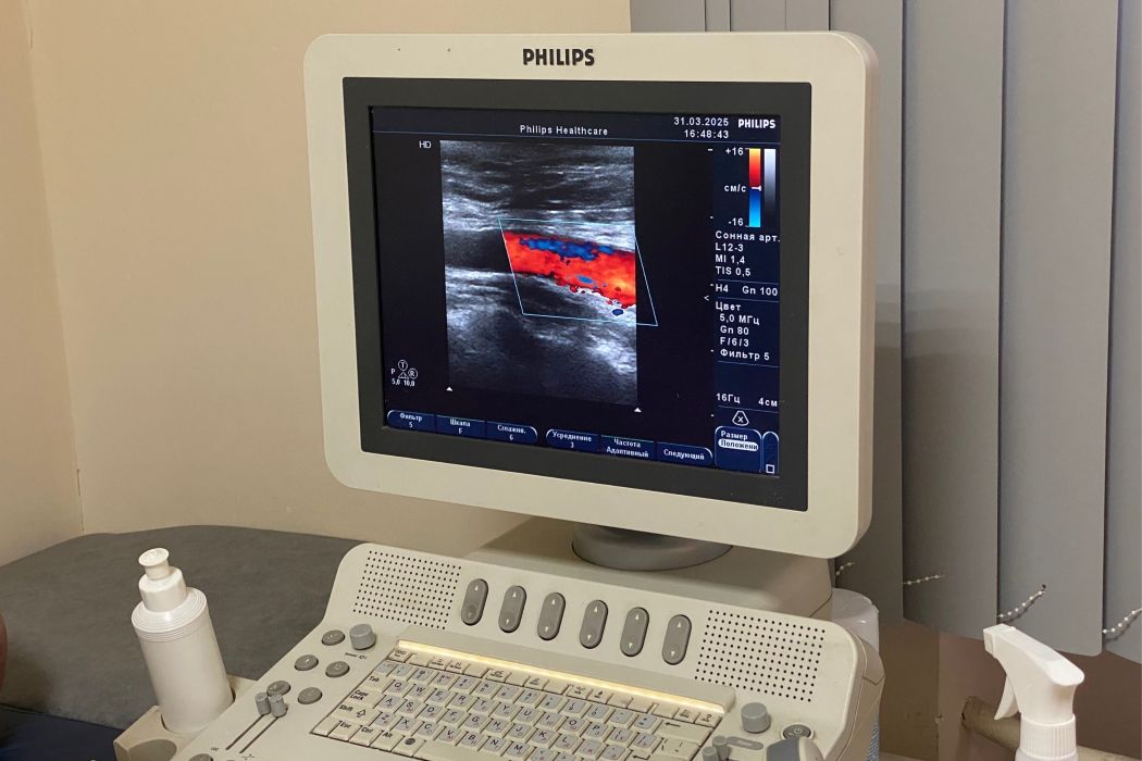 Врач сыктывкарской поликлиники объяснил, зачем нужно делать УЗИ сосудов шеи