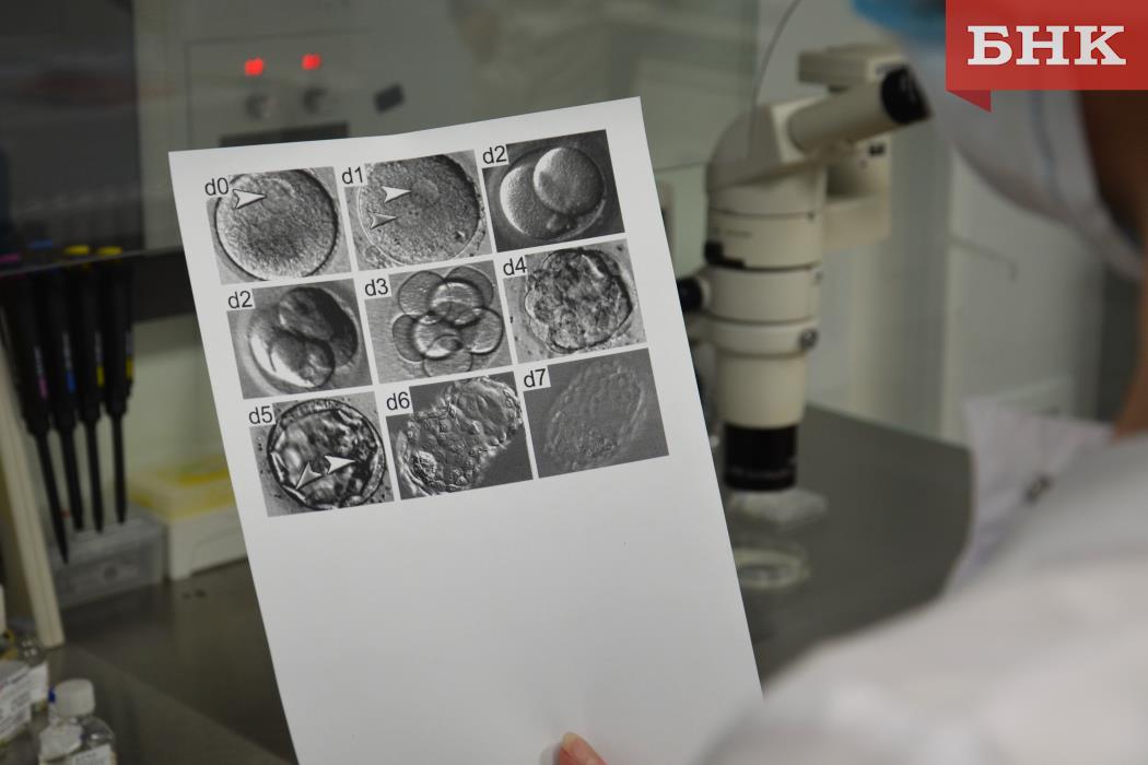 Цифра дня: сколько сыктывкарок прошли репродуктивную диспансеризацию