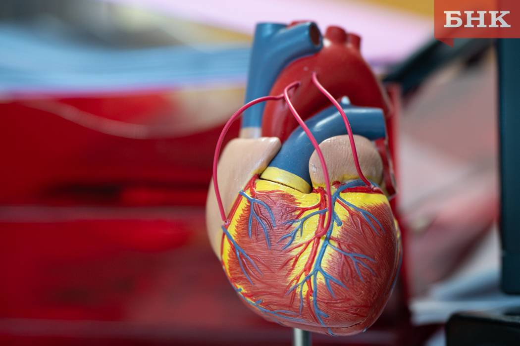 В Коми «молодеют» болезни сердца и сосудов